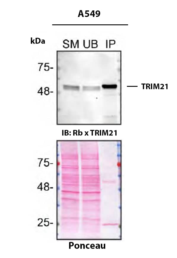 Detection of TRIM21 by Immunoprecipitation.