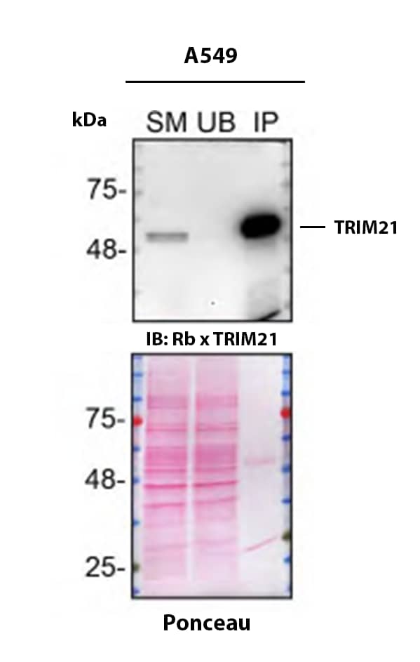 Detection of TRIM21 by Immunoprecipitation.