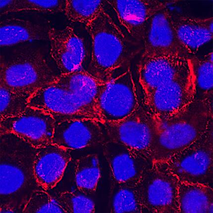 ALCAM/CD166 antibody in A431 Human Cell Line by Immunocytochemistry (ICC).
