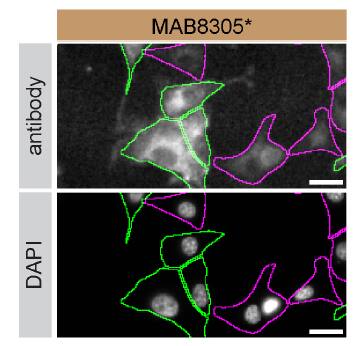Rab13 Specificity is Shown by Immunocytochemistry in Knockdown Cell Line.