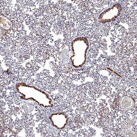 ACE-2 antibody in Hamster Lung by Immunohistochemistry (IHC-P).