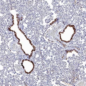 ACE-2 antibody in Hamster Lung by Immunohistochemistry (IHC-P).