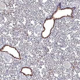 ACE-2 antibody in Hamster Lung by Immunohistochemistry (IHC-P).