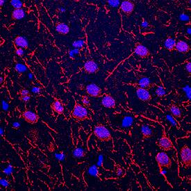 nNOS antibody in Rat Brain by Immunohistochemistry (IHC-Fr).