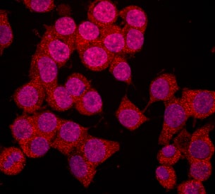 nNOS antibody in Neuro-2A Mouse Cell Line by Immunocytochemistry (ICC).