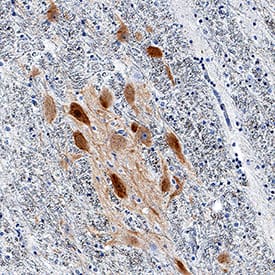 nNOS antibody in Human Brain by Immunohistochemistry (IHC-P).