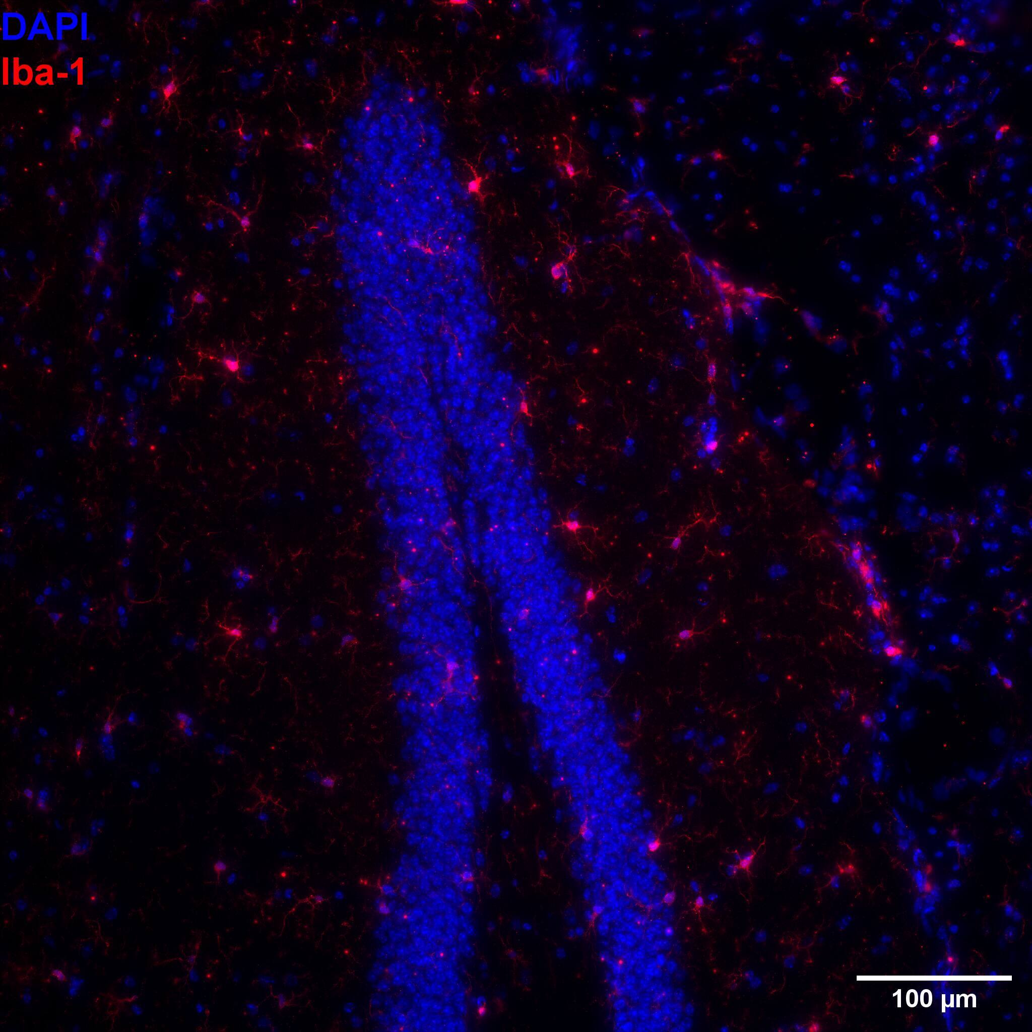AIF-1/Iba1 Antibody