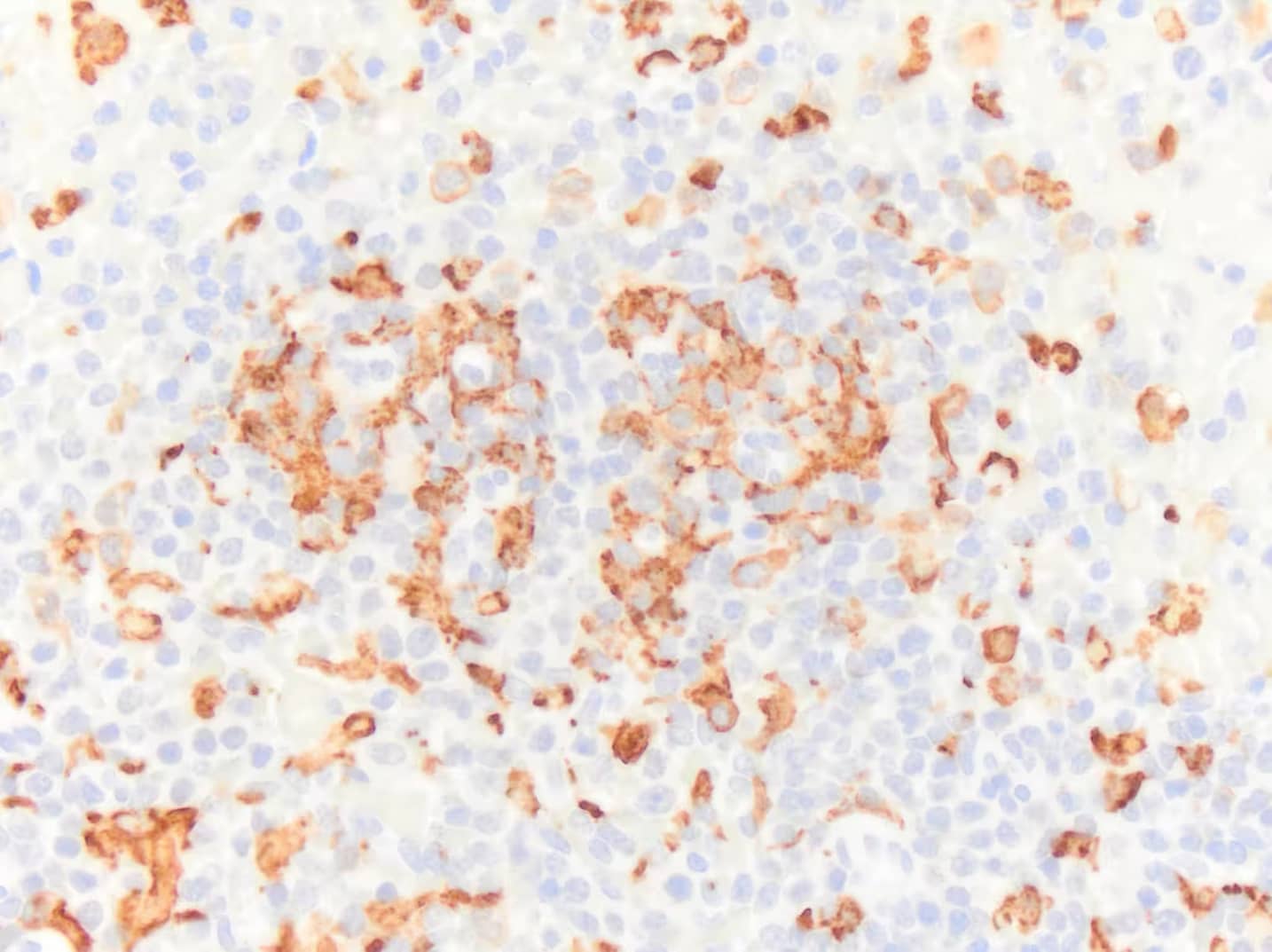 AIF-1/Iba1 Antibody