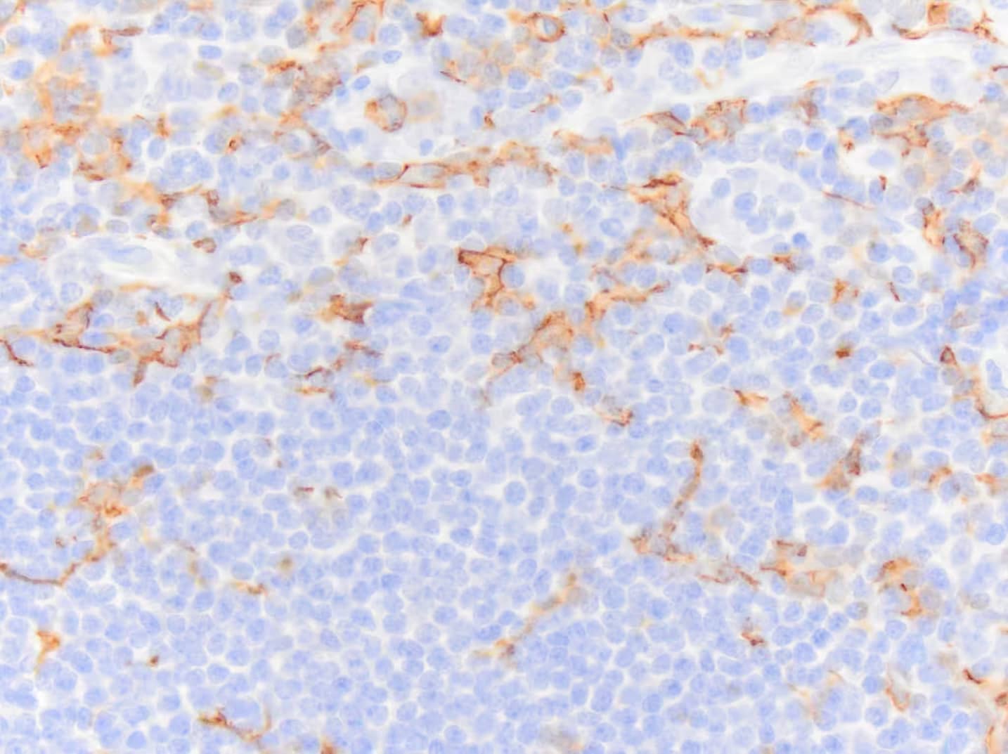 AIF-1/Iba1 Antibody