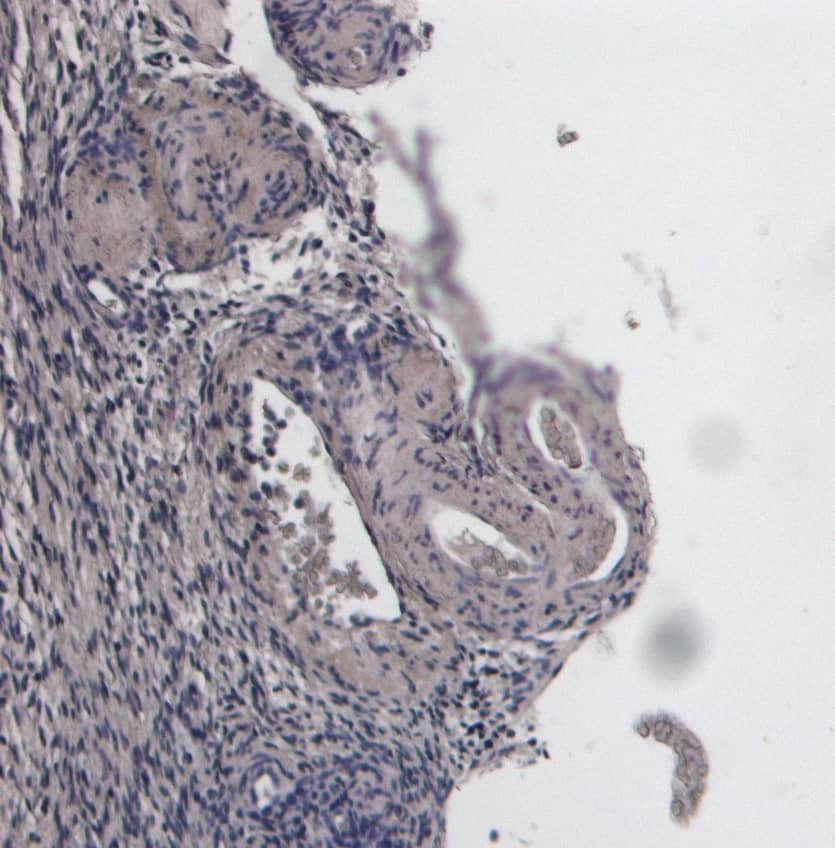 FOXL2 Antibody