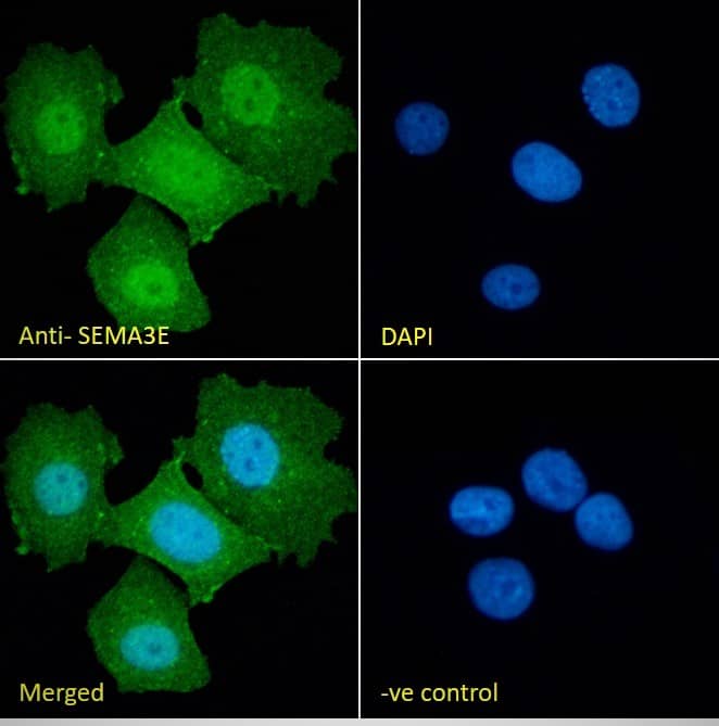 Semaphorin 3E Antibody