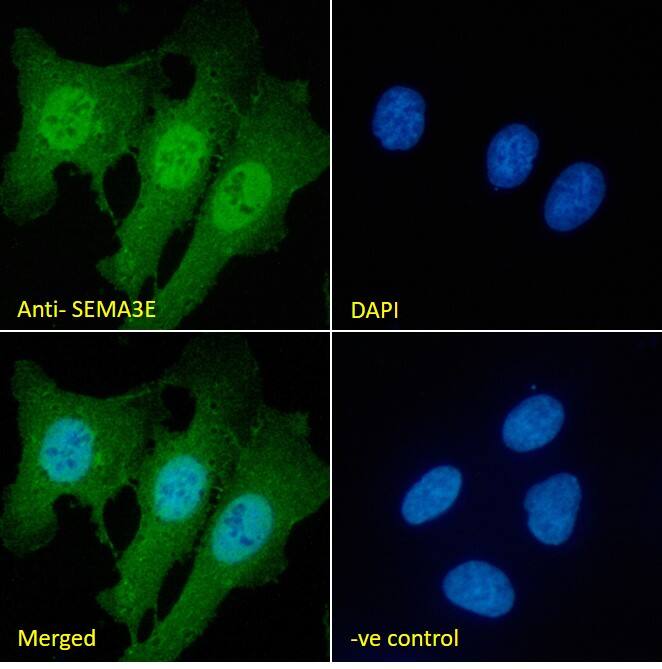 Semaphorin 3E Antibody