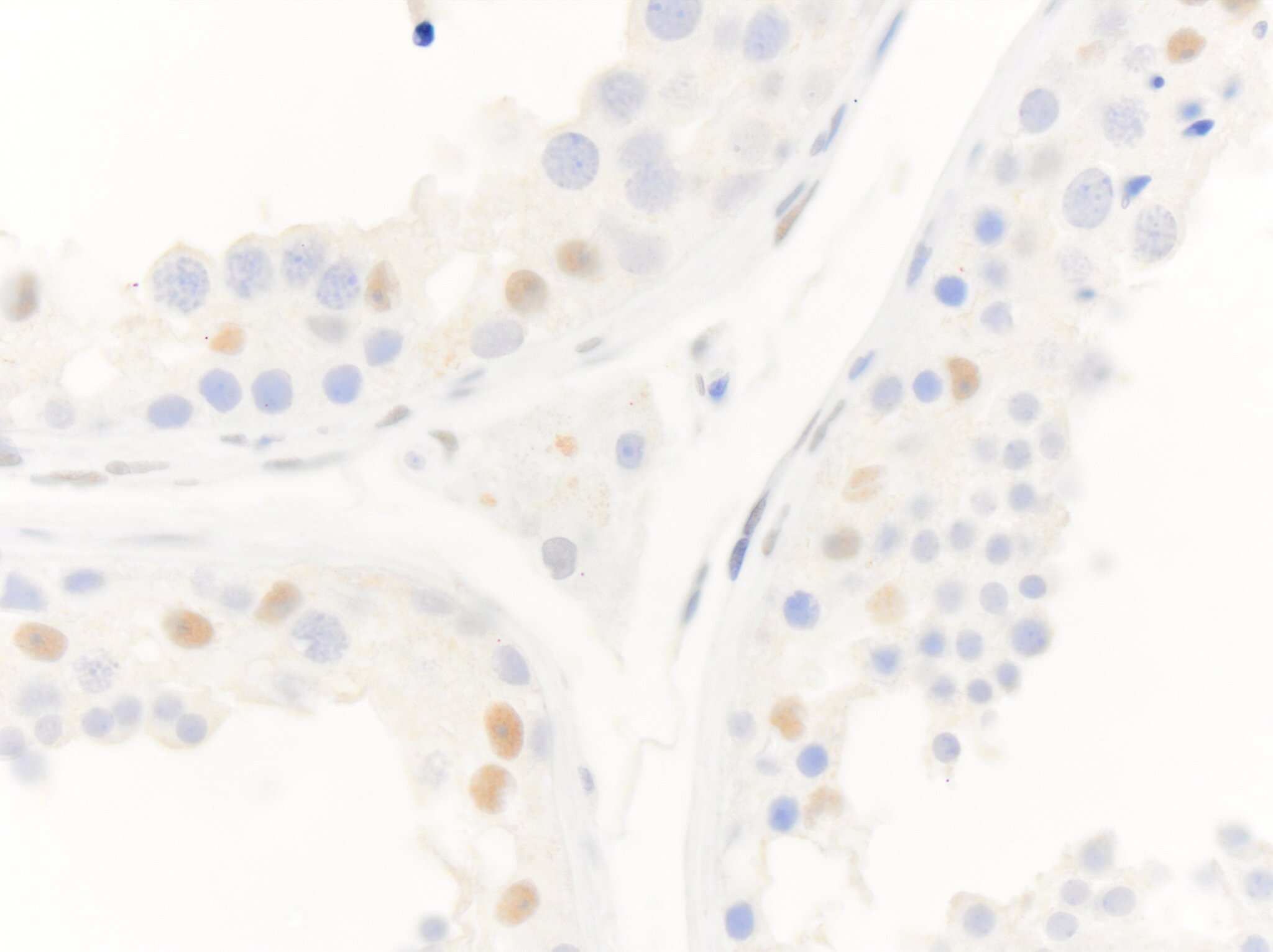 Androgen R/NR3C4 Antibody