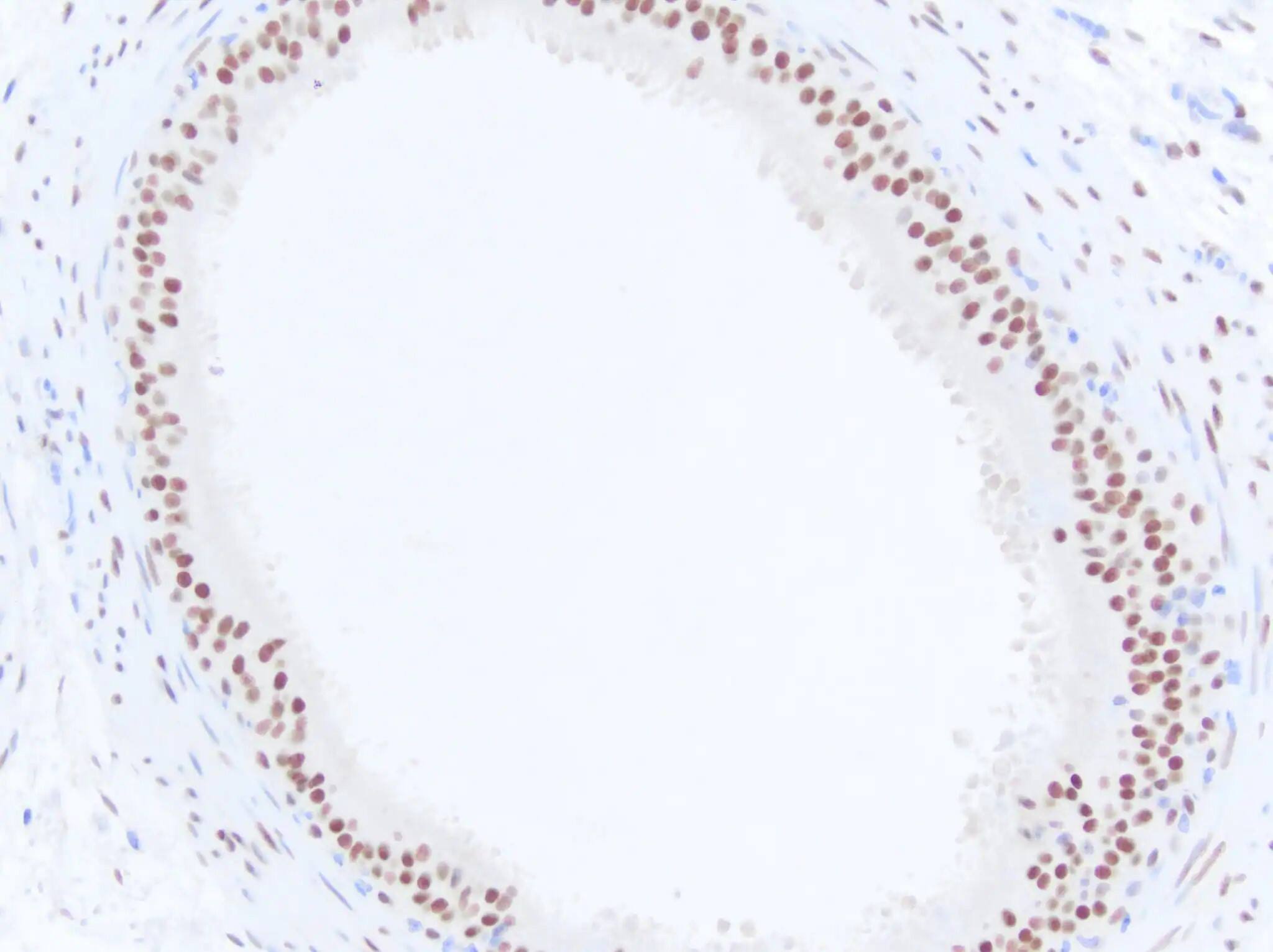 Androgen R/NR3C4 Antibody