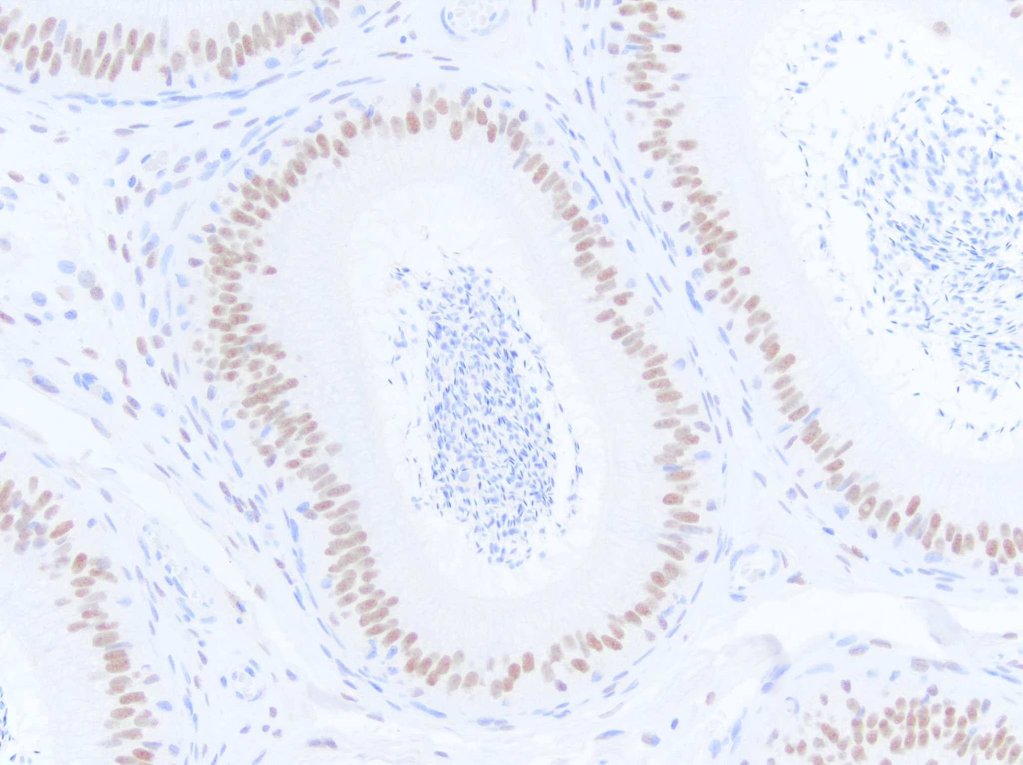 Androgen R/NR3C4 Antibody
