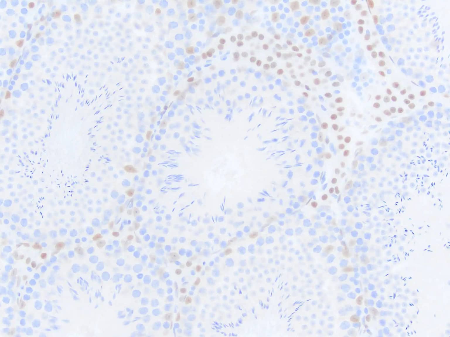 Androgen R/NR3C4 Antibody