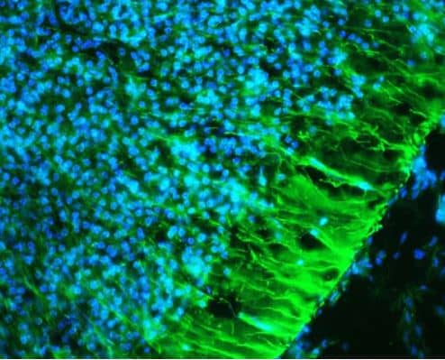 Nestin Antibody Immunohistochemistry: Nestin Antibody [NB100-1604]