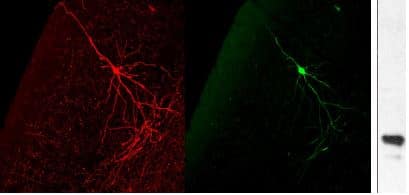 GFP Antibody Immunocytochemistry/Immunofluorescence: GFP Antibody [NB100-1614]