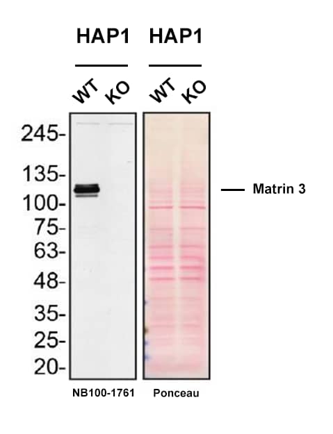 Matrin 3 Antibody