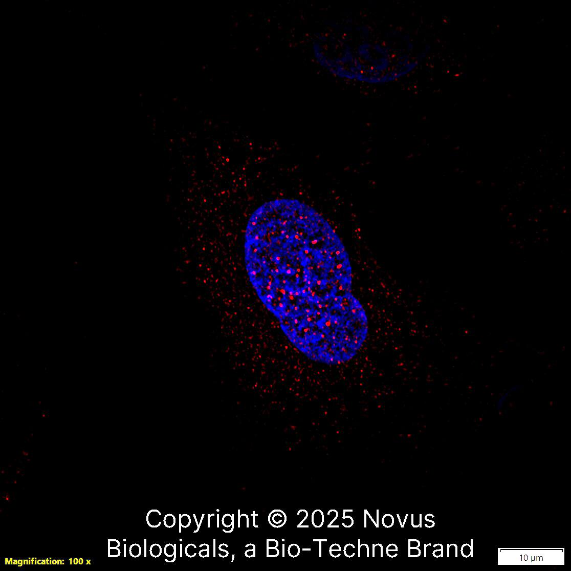 FANCD2 Antibody - BSA Free