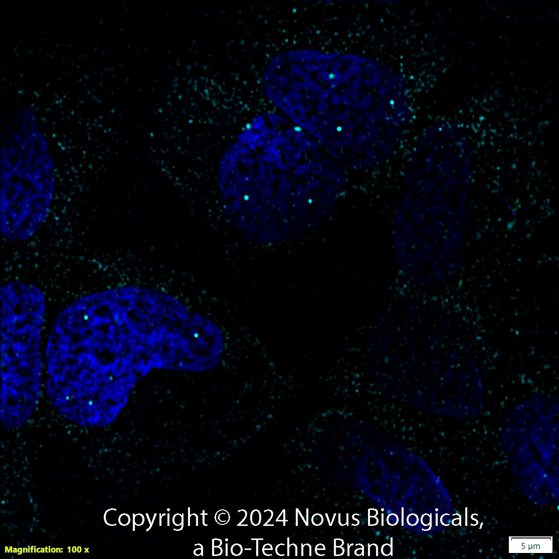 SMN Antibody (2B1)