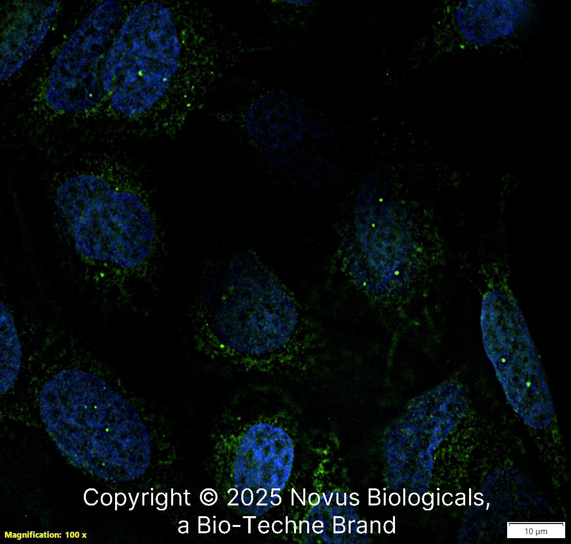 SMN Antibody (2B1) - BSA Free