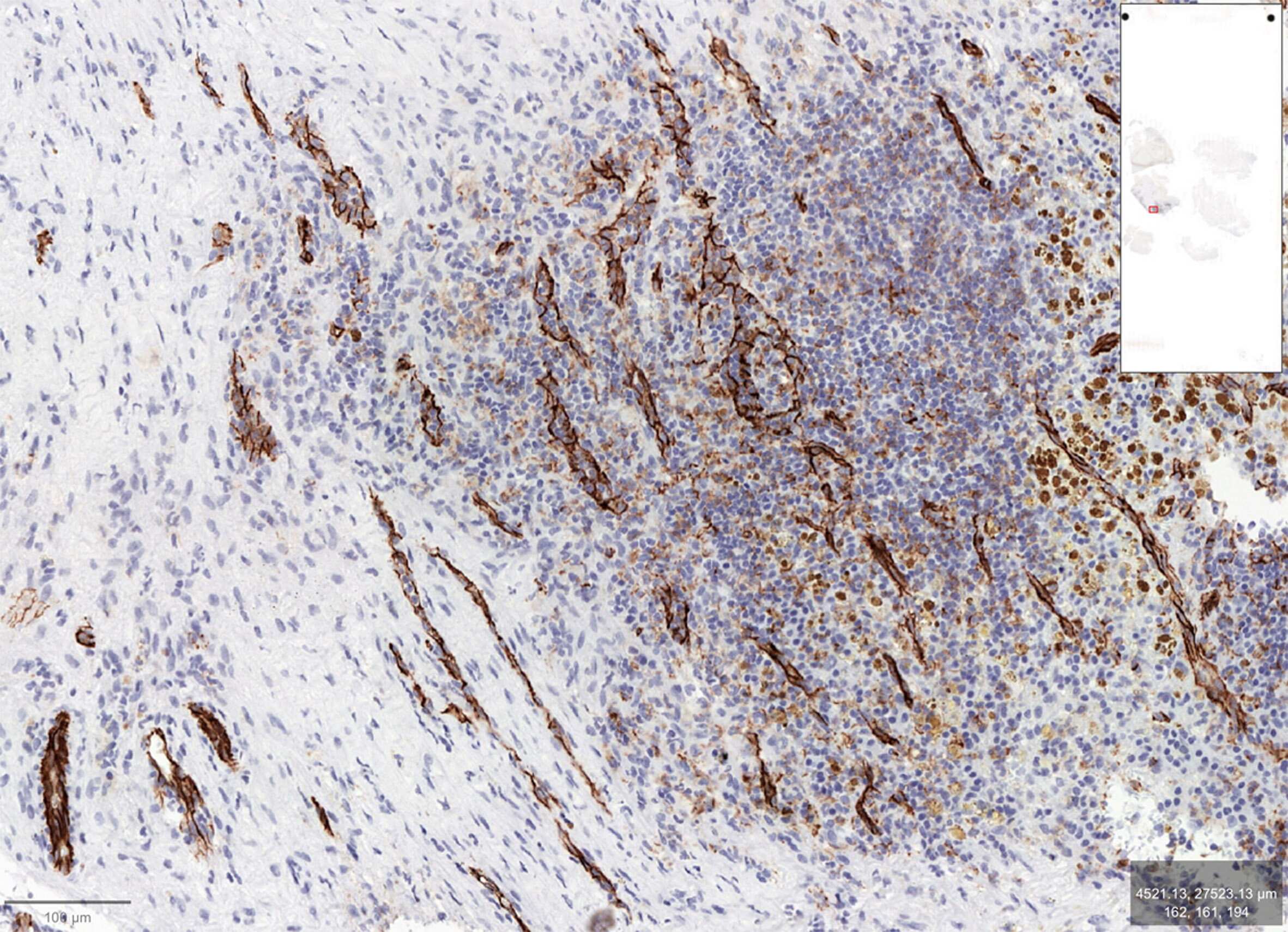 CD31/PECAM-1 Antibody (NB100-2284) by Novus, Part of Bio-Techne CD31/PECAM-1 Antibody (NB100-2284) by Novus, Part of Bio-Techne
