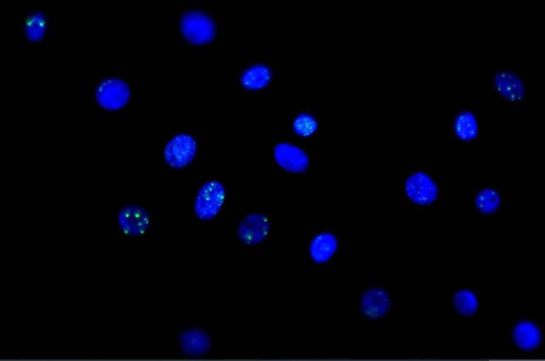Cells Stained with 53BP1 Antibody in Immunocytochemistry/Immunofluorescence