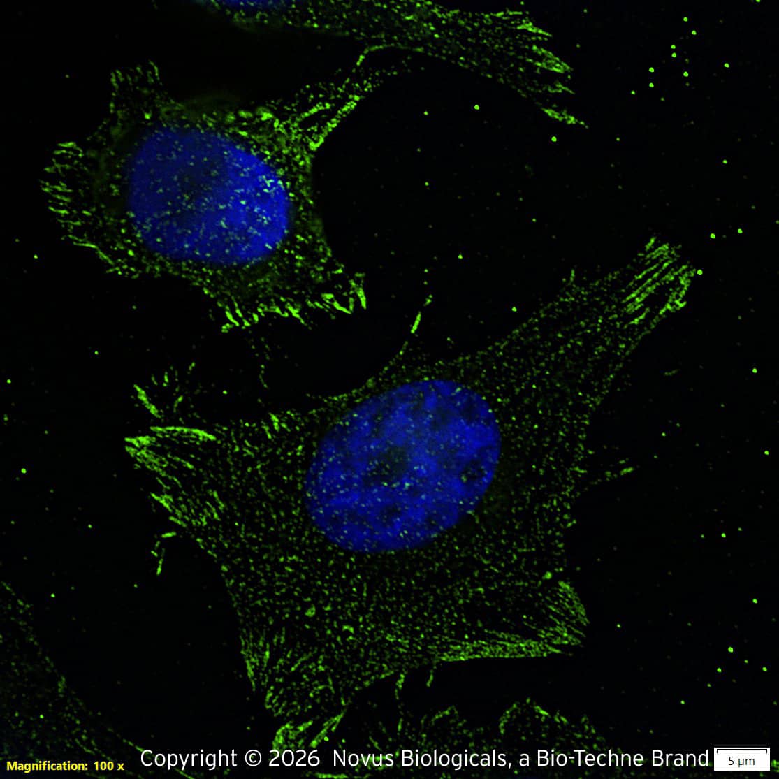 14-3-3 gamma [ac Val2] Antibody (KC21) - BSA Free Immunocytochemistry/Immunofluorescence: 14-3-3 gamma [ac Val2] Antibody (KC21)