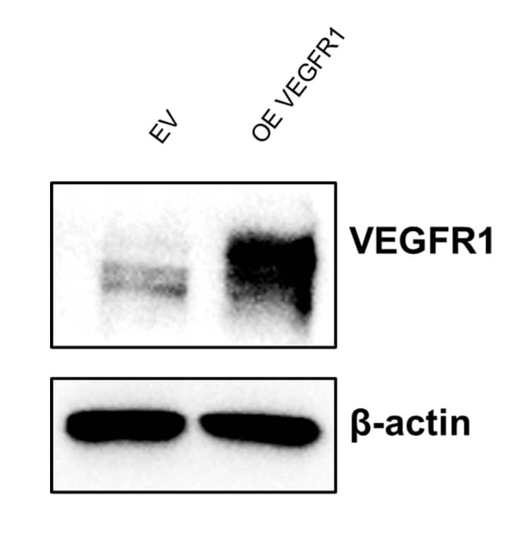 VEGFR1/Flt-1 Antibody - BSA Free Western Blot: Rabbit Polyclonal VEGFR1/Flt-1 Antibody [NB100-527]