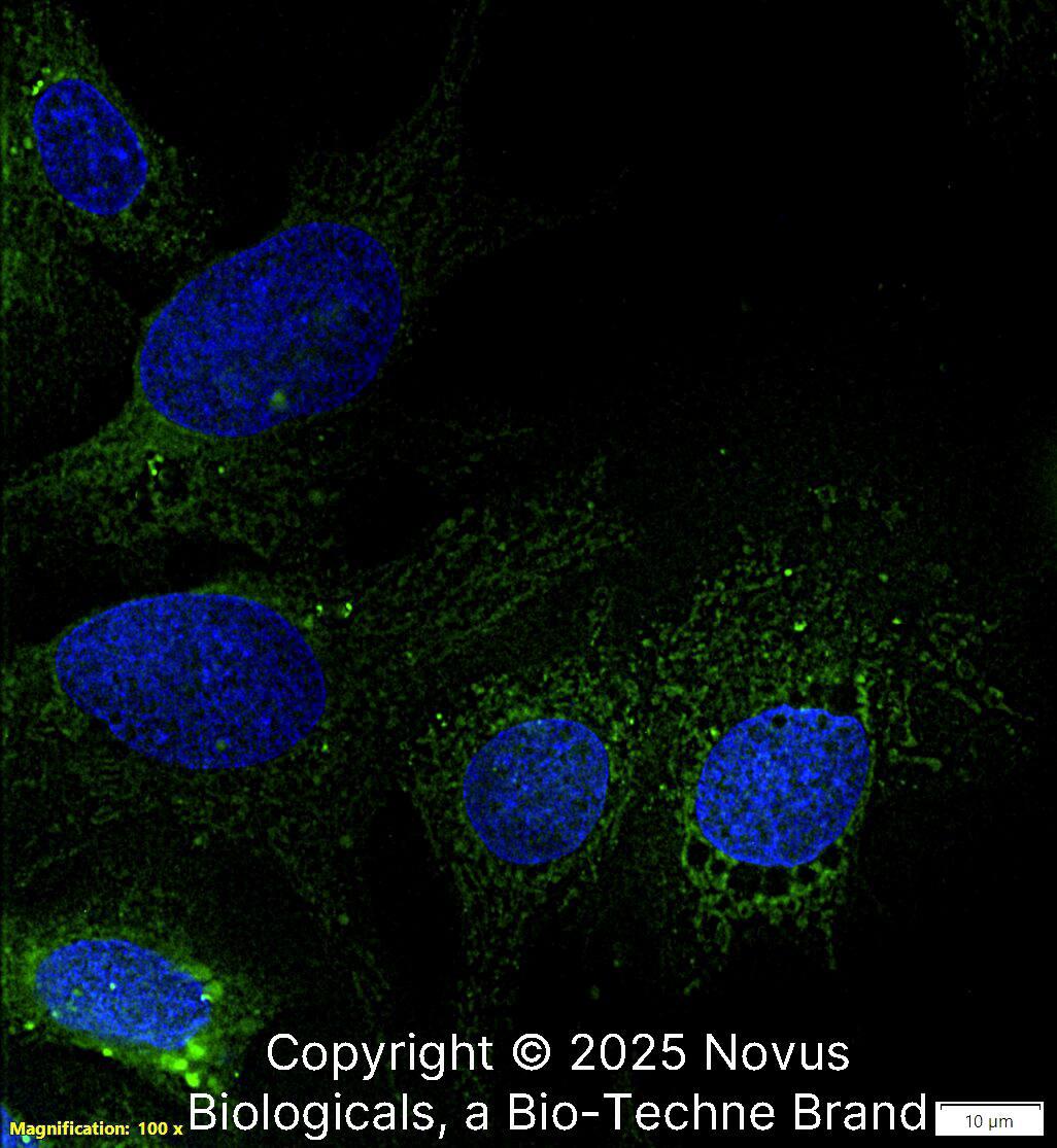 IkB-alpha Antibody (6A920) - BSA Free
