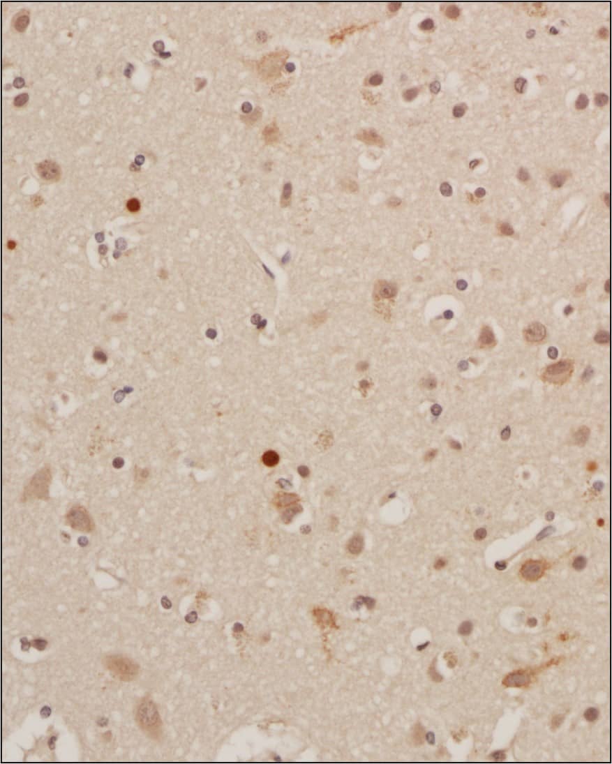 RANK/TNFRSF11A Antibody (9A725) - BSA Free Immunohistochemistry-Paraffin: RANK/TNFRSF11A Antibody (9A725)BSA Free [NB100-56508]