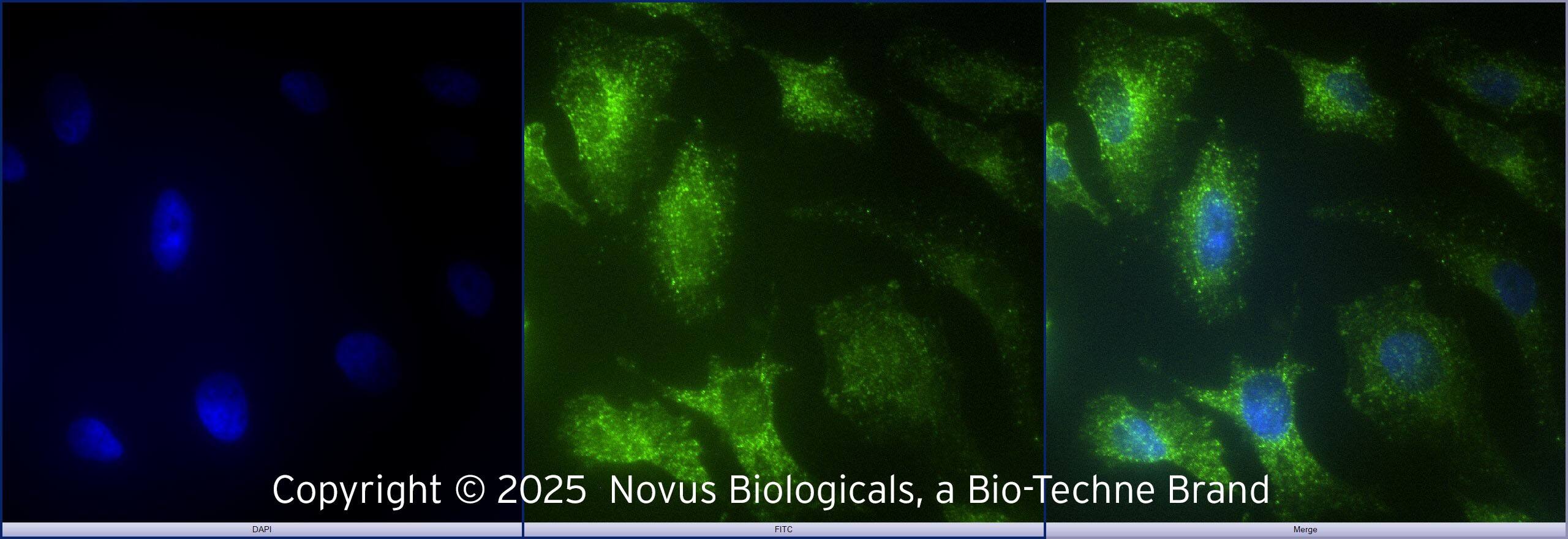 TLR2 Antibody - BSA Free Immunocytochemistry / Immunofluorescence: TLR2 Antibody [NB100-56720]
