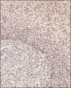 TLR2 Antibody - BSA Free Immunohistochemistry: TLR2 Antibody [NB100-56720]