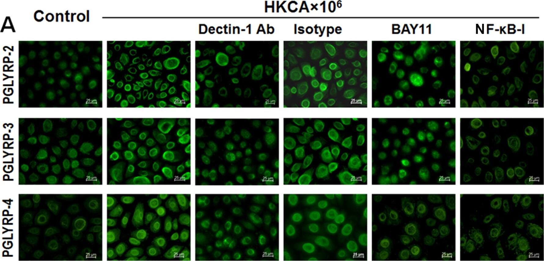 PGLYRP3/PGRPIA Antibody (187C434)