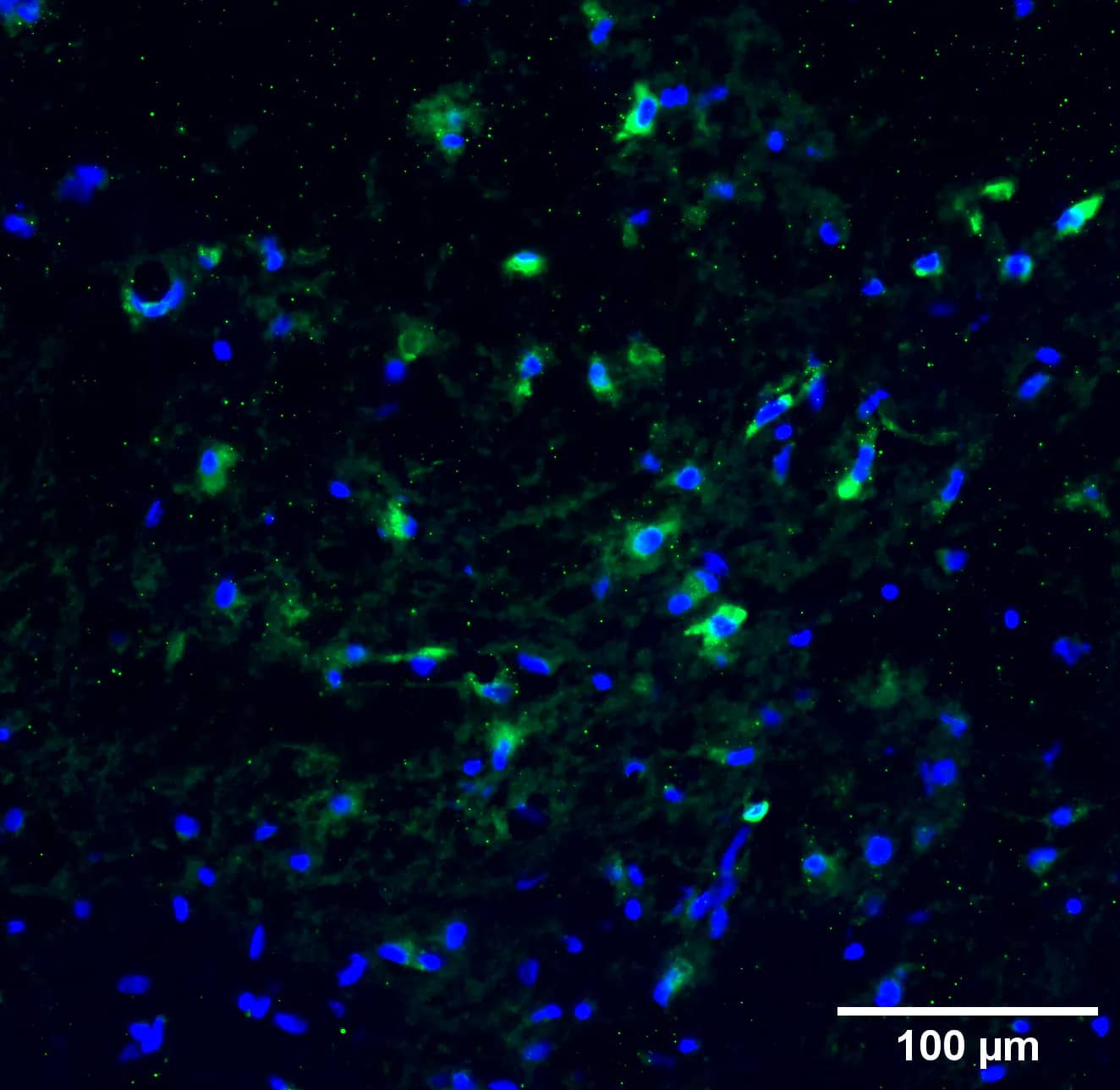 Histone H3 [Citrulline Arg17, Citrulline Arg2, Citrulline Arg8] Antibody