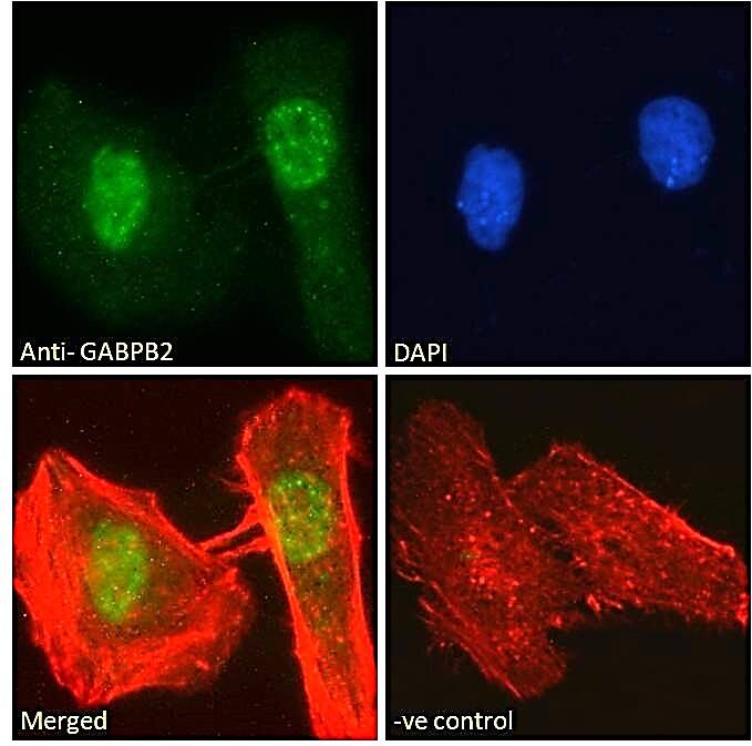 GABPB1 Antibody