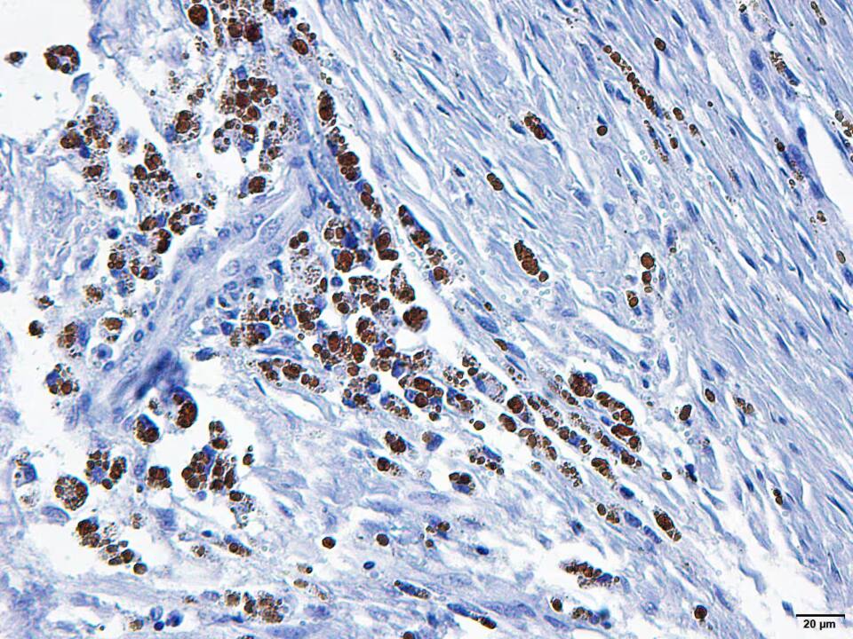 VEGF Antibody (VG76e) - BSA Free