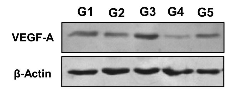 VEGF Antibody (VG76e) - BSA Free