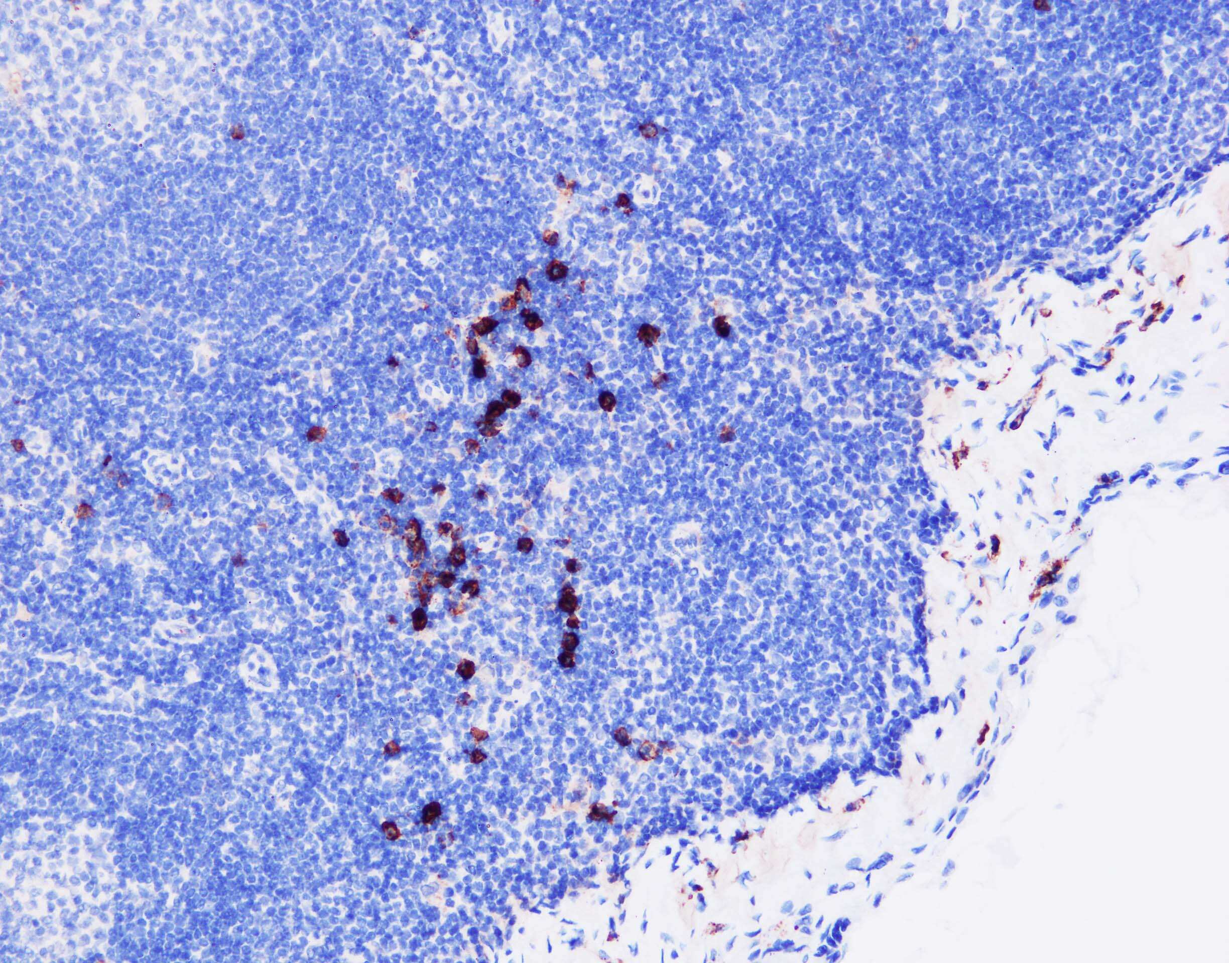 Syndecan-1/CD138 Antibody (B-A38)
