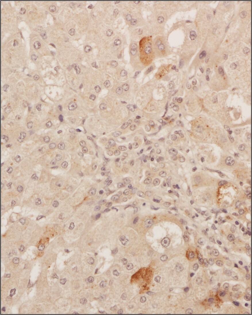 VEGF Antibody (VG1) - BSA Free Immunohistochemical Analysis of VEGF in Paraffin Embedded Human Liver