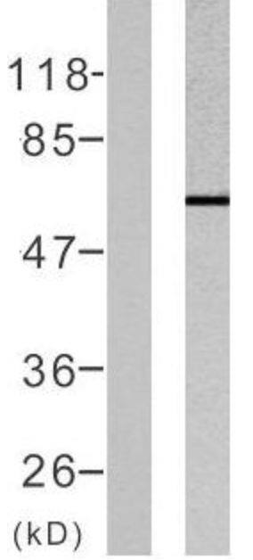 ER alpha/NR3A1 [p Ser106] Antibody