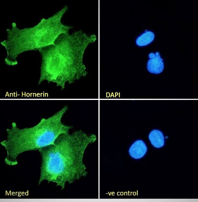 Hornerin Antibody