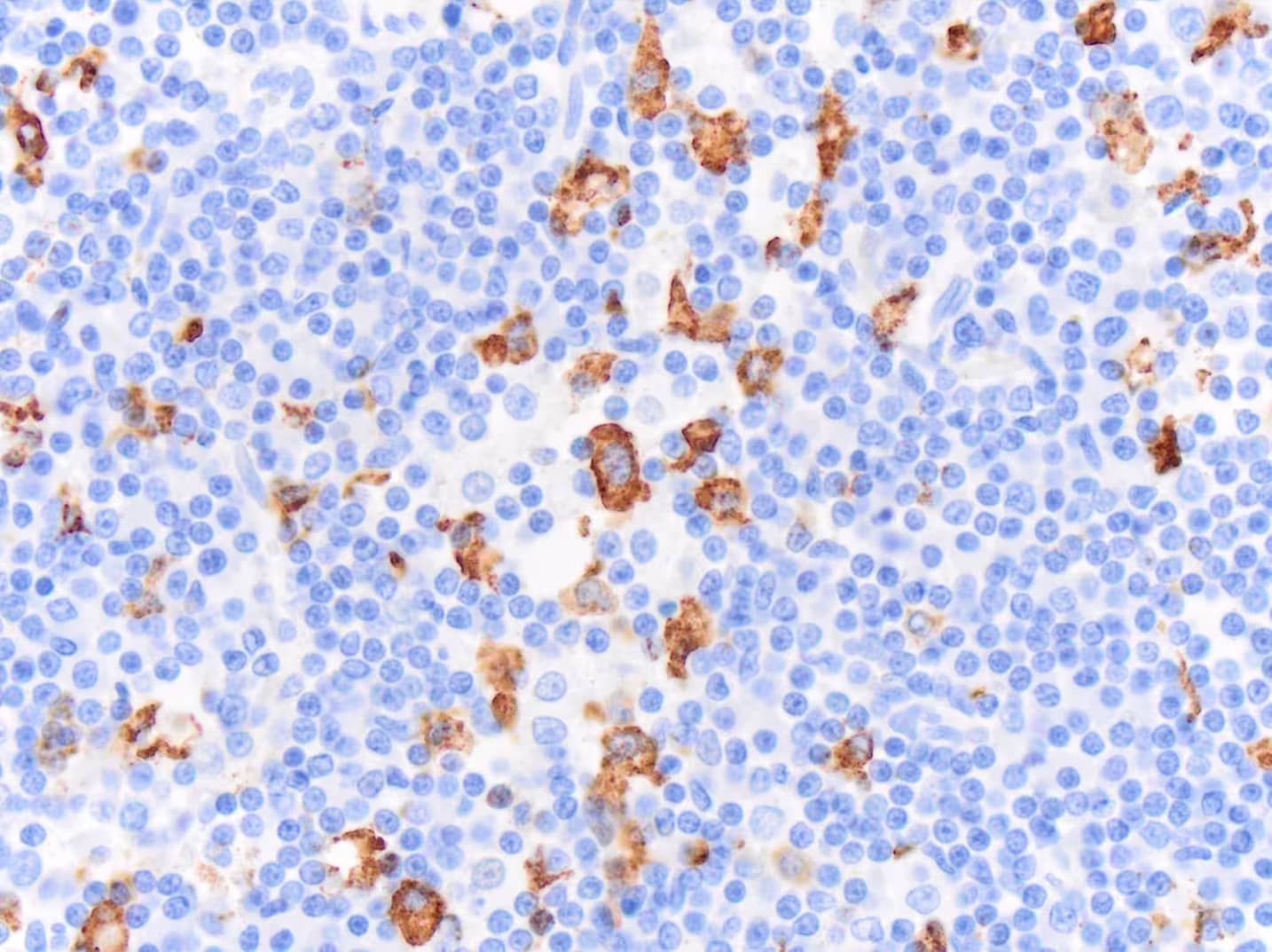 CD163 Antibody (EDHu-1) - BSA Free