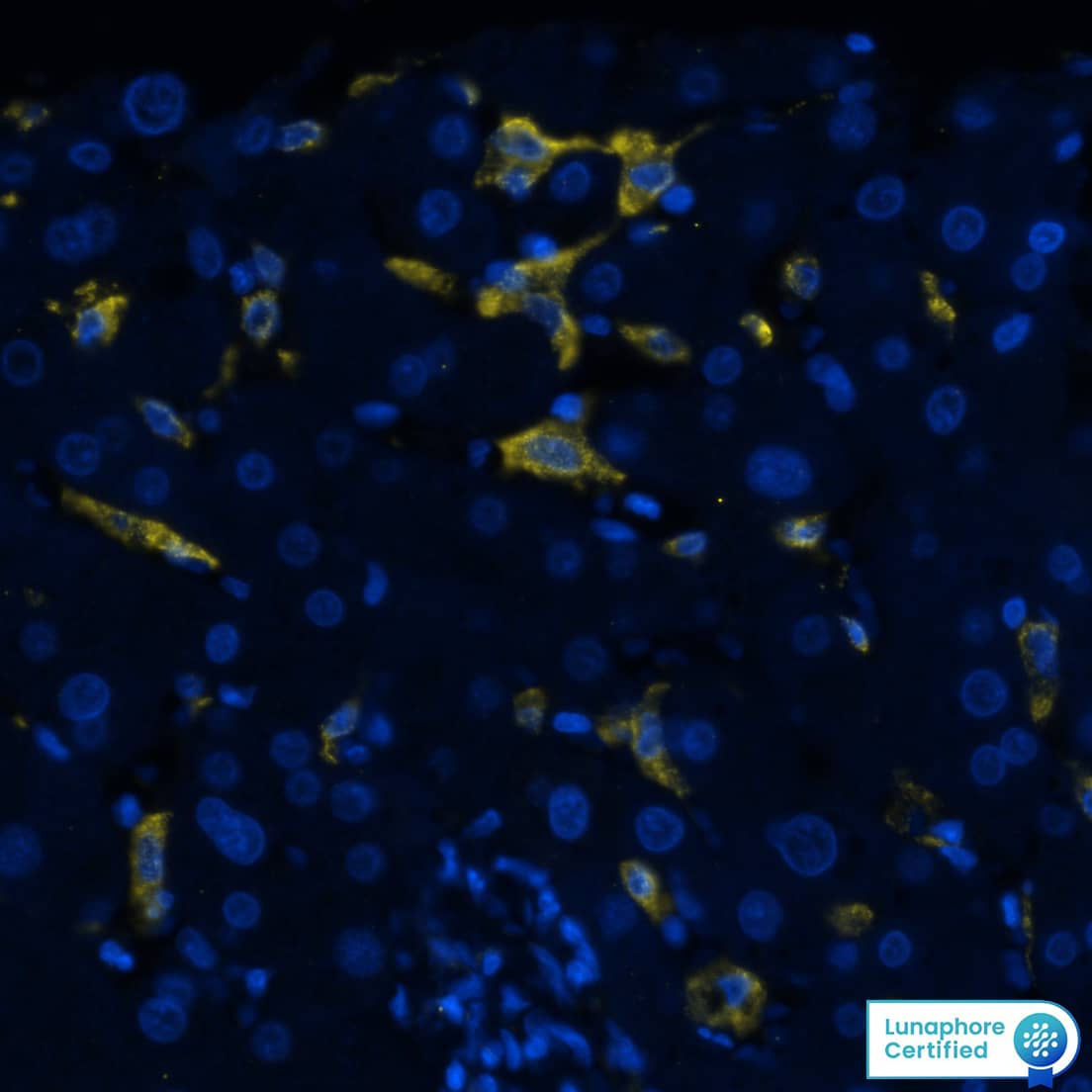 CD163 Antibody (EDHu-1)