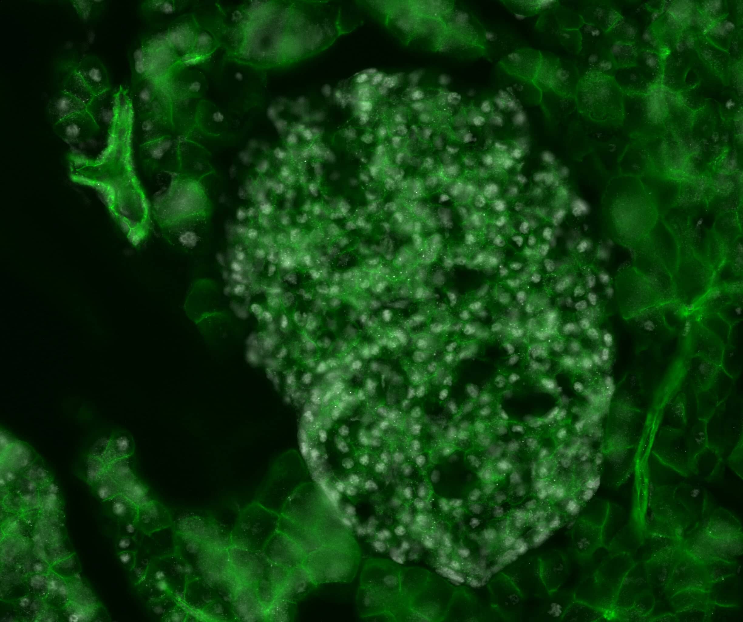 YAP1 Antibody - BSA Free Immunohistochemistry: Rabbit Polyclonal YAP1 Antibody [NB110-58358]