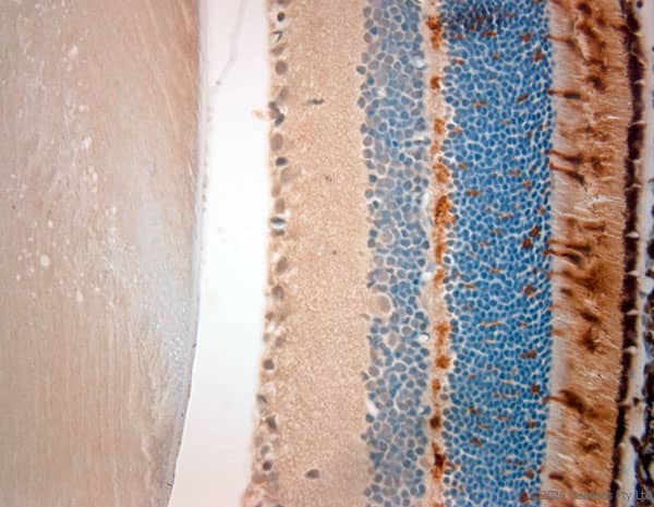 Opsin 1 (Medium Wave) Antibody