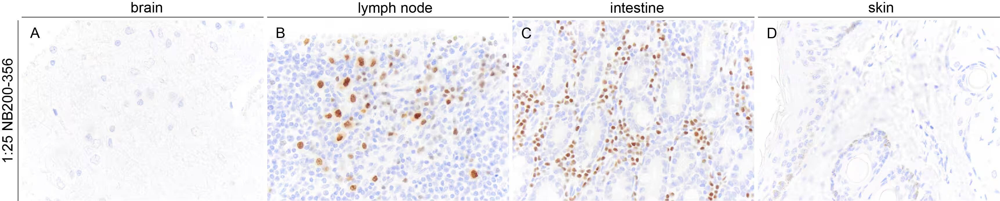 MUM1 Antibody (MUM1p)