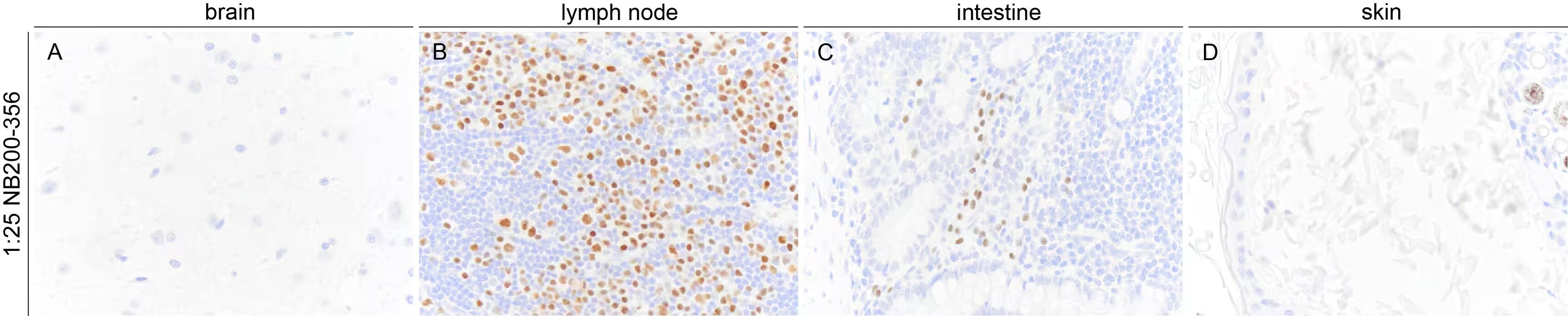 MUM1 Antibody (MUM1p)