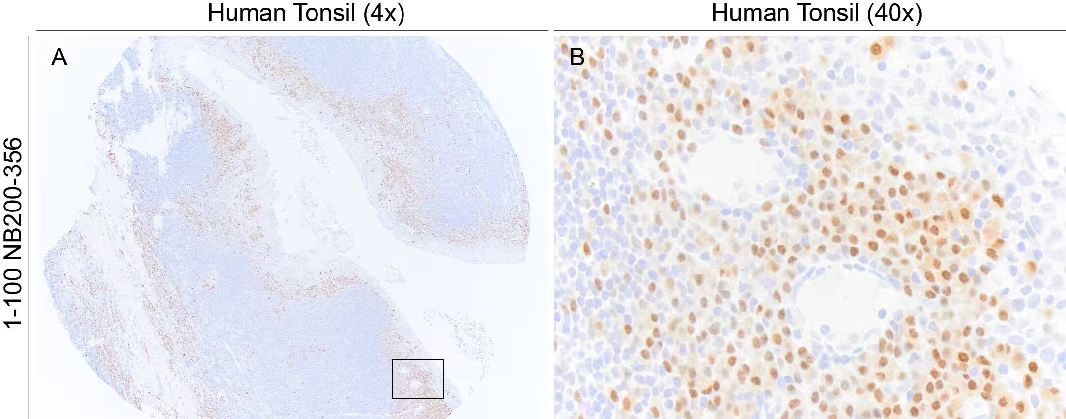 MUM1 Antibody (MUM1p)